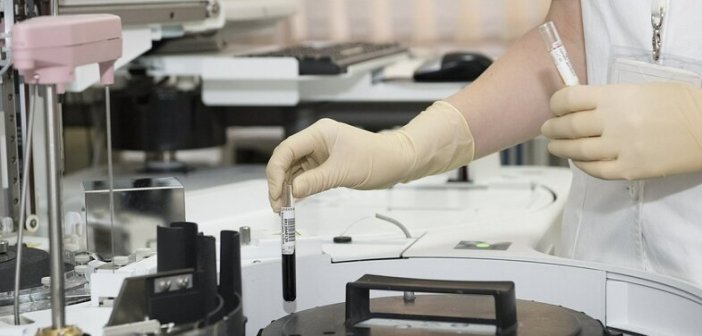 ΕΟΔΥ: Αρχικά ανακοίνωσε δύο θανάτους, αλλά τελικά ήταν ένας…